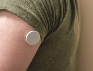 An Abbott FreeStyle Libre flash-glucose monitoring sensor installed on the back of the upper arm.